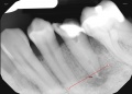 20171106 dental xrays (12).jpg