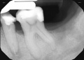 20171106 dental xrays (13).jpg